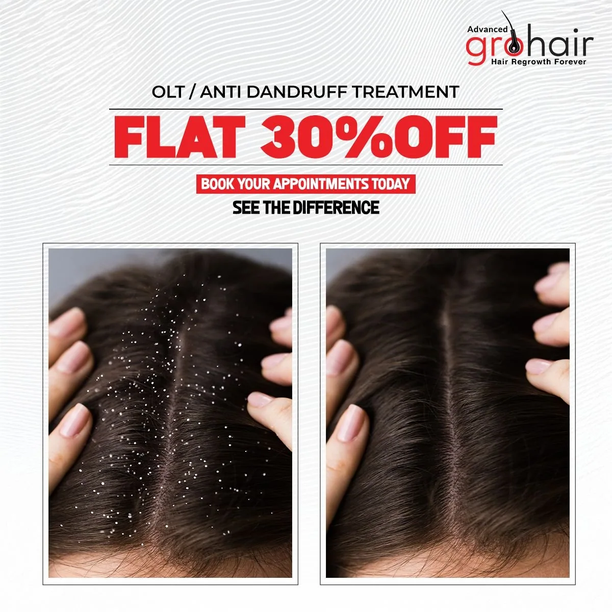 Hair transplant at ₹99,999 — unlimited follicles