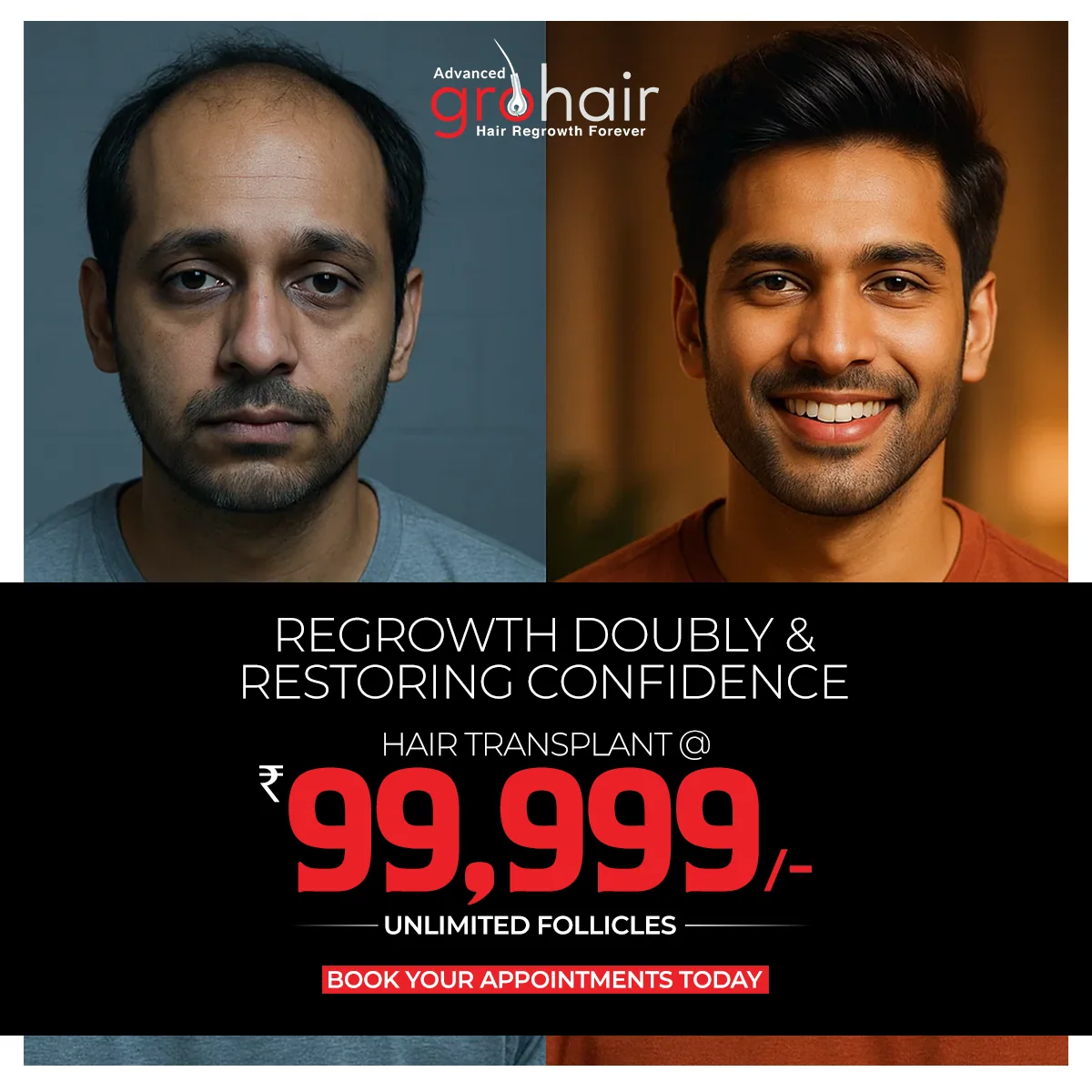 Flat 30% off GFC and hair regrowth treatment