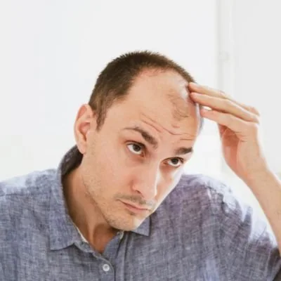 Man examining thinning hair