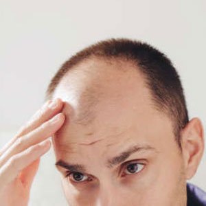hair loss treatment price